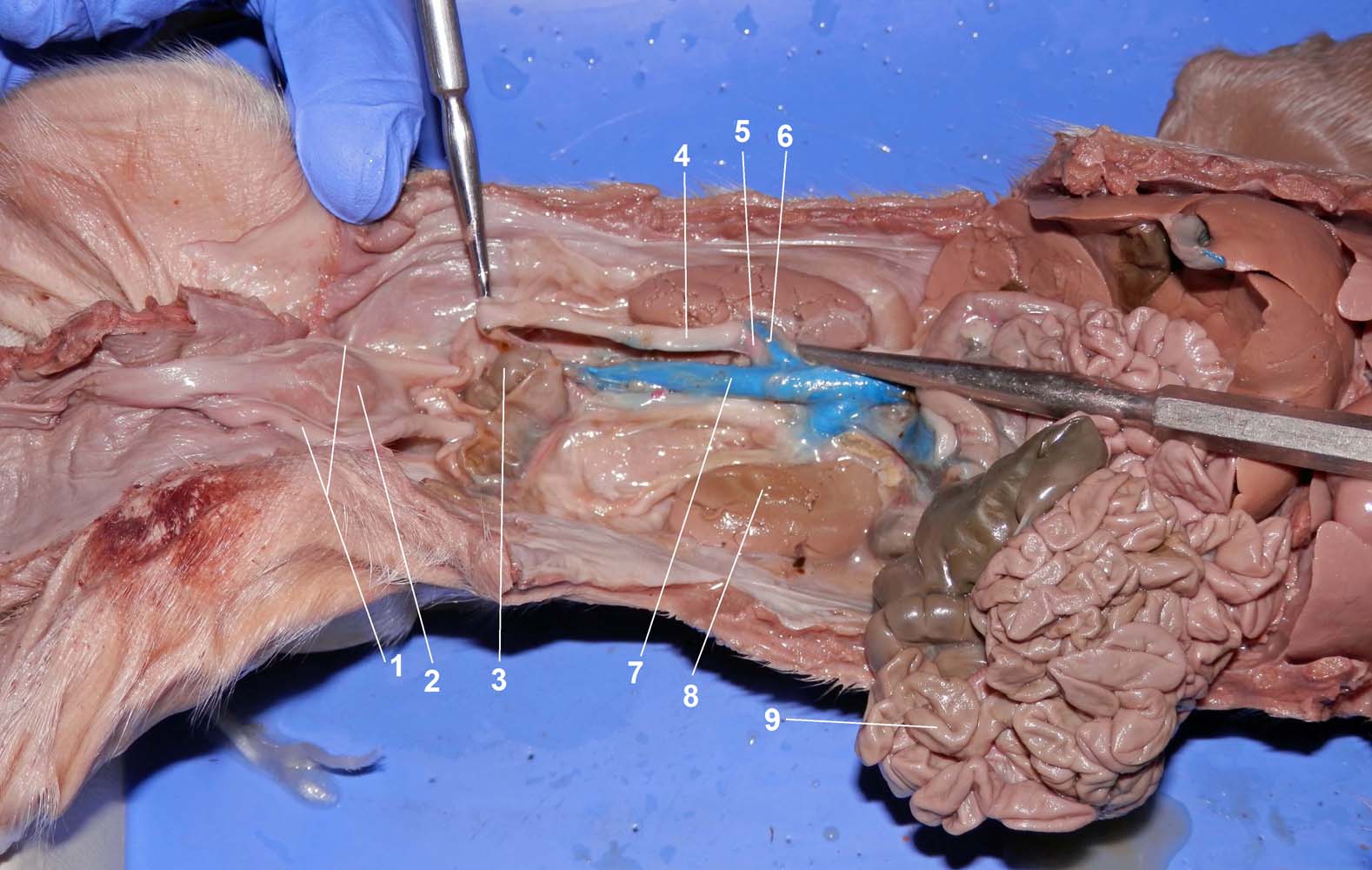 Abdominal and Pelvic Structures