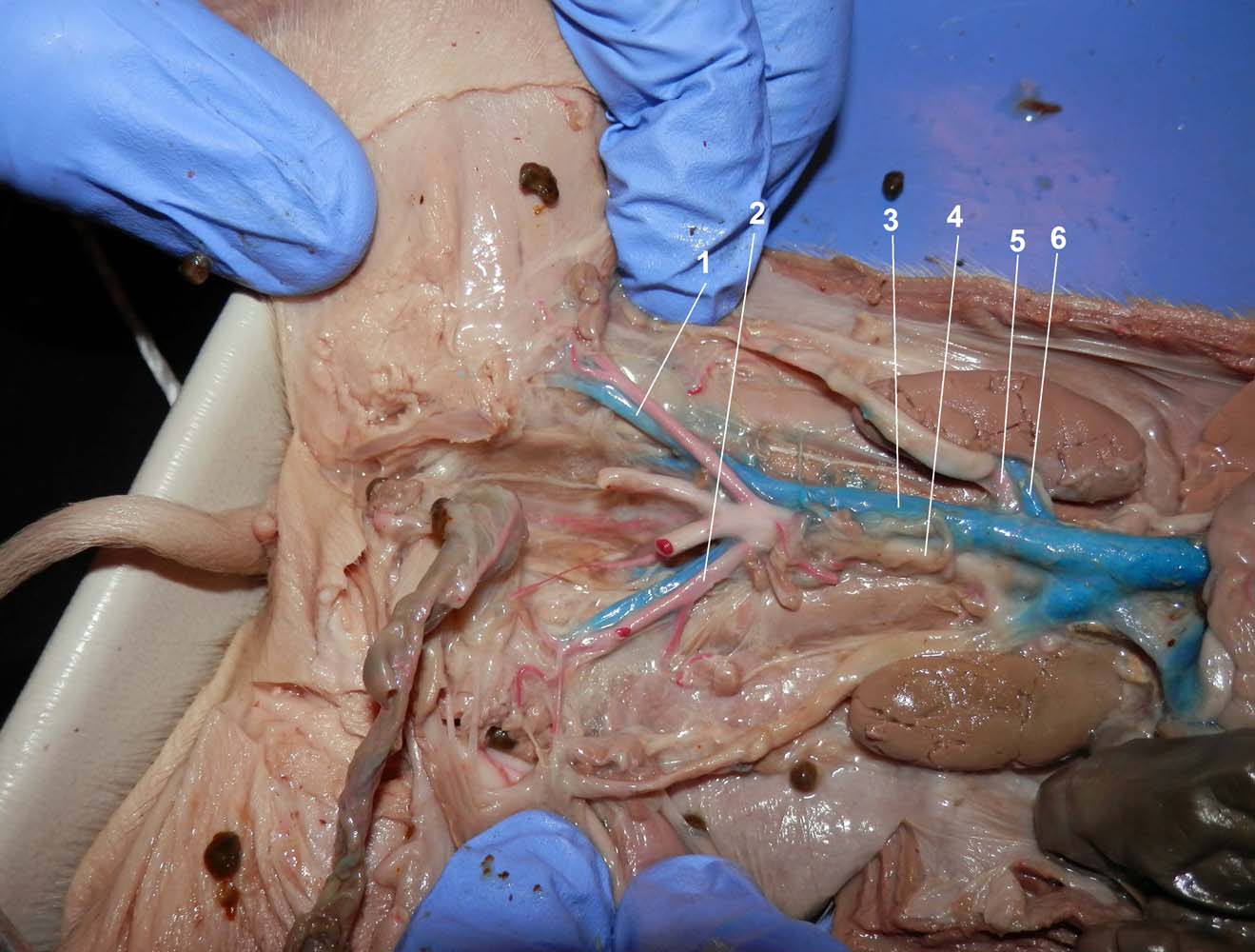 Abdominal Blood Vessels