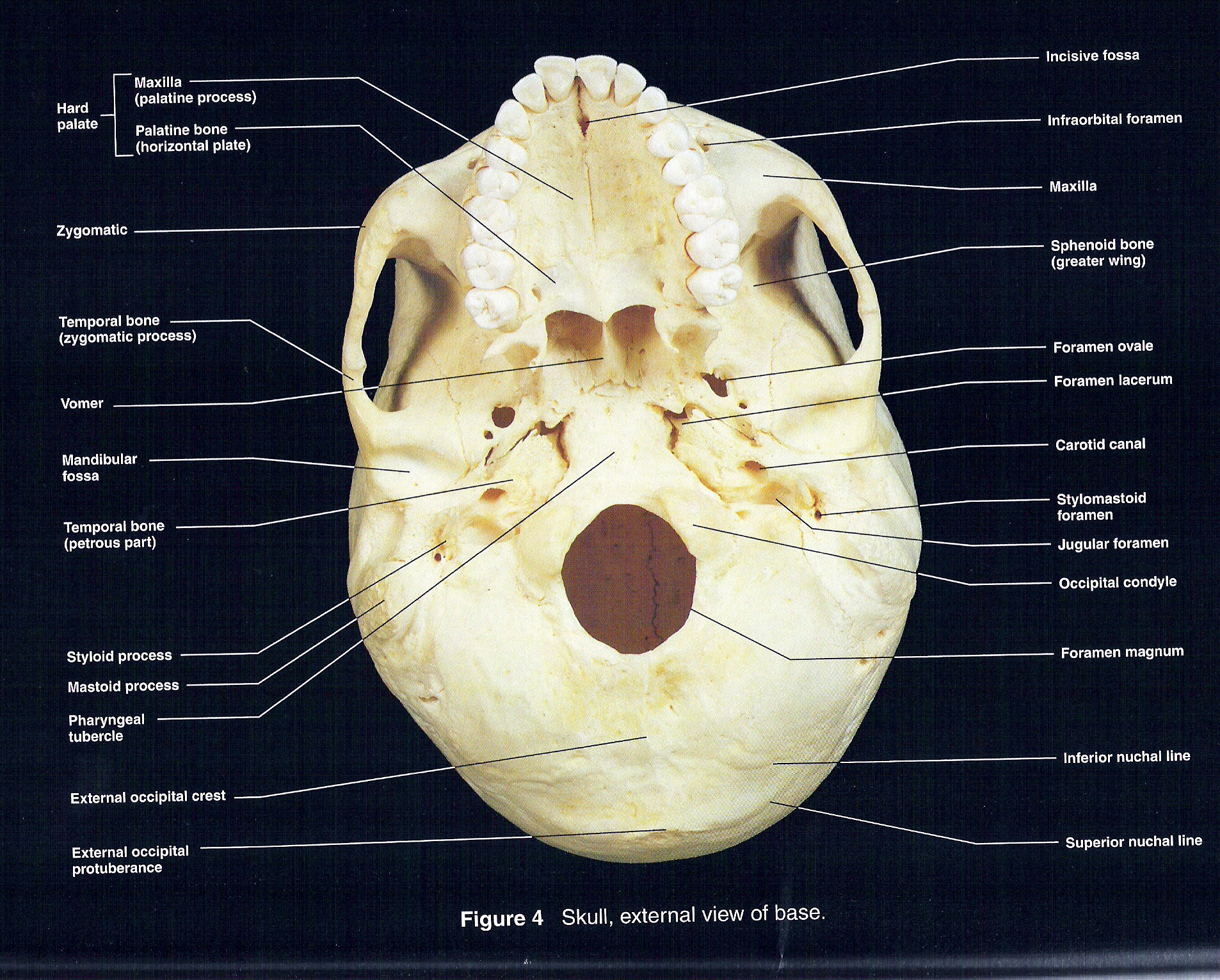 Human Skull Anatomy Inferior View 0452