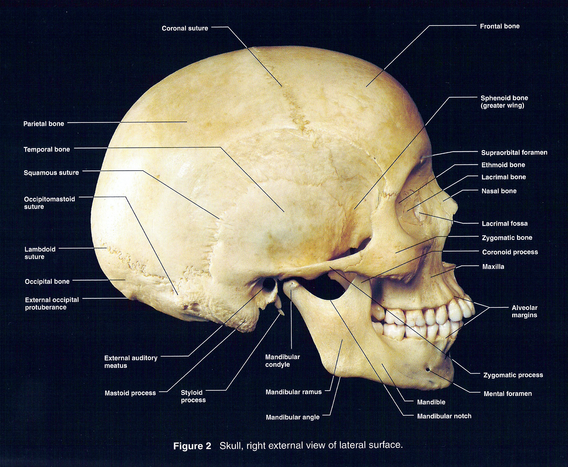 Lateral View Of Skull